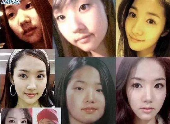 济南整容谁爆料的视频最多,揭秘网络热议背后的真相